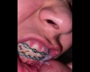 19yrs old BRACES CUMSHOT