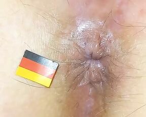 Germany Anus